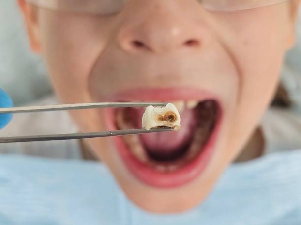Best Urgent Dental Care for Toothaches in Fern Acres, HI